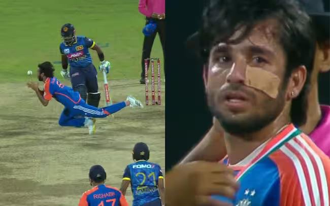 Ravi Bishnoi Braves Injury During Bowling vs Sri Lanka In 1st T20I. Internet Bows Down